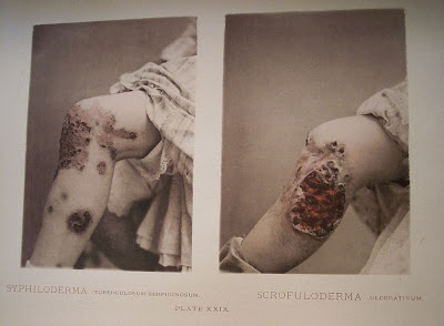 prostitute history